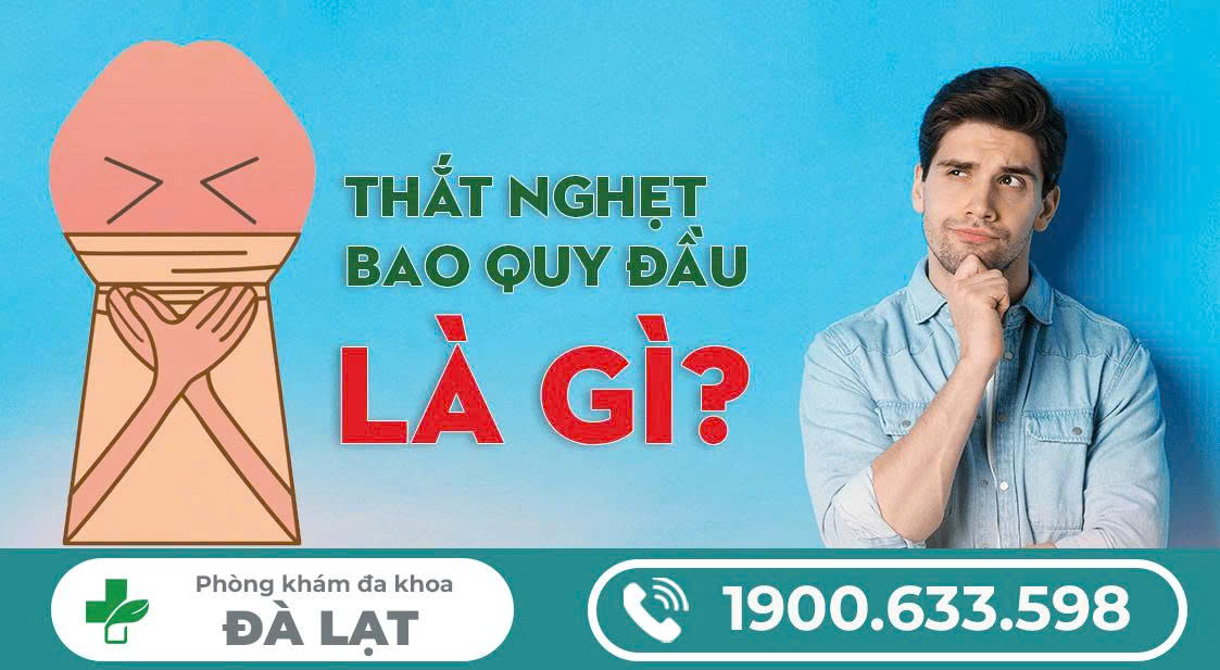 Hình ảnh minh họa